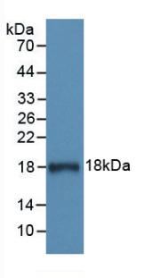 Monoclonal Antibody to Complement 1 Inhibitor (C1INH)