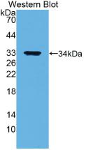 Monoclonal Antibody to Annexin V (ANXA5)