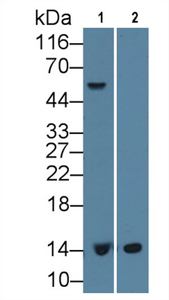 Monoclonal Antibody to Beta-2-Microglobulin (b2M)