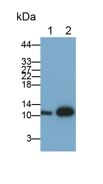 Monoclonal Antibody to Beta-2-Microglobulin (b2M)