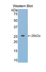 Monoclonal Antibody to Cathepsin K (CTSK)