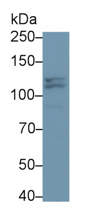 Monoclonal Antibody to Poly ADP Ribose Polymerase (PARP)