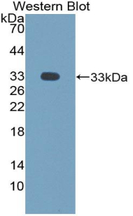 Monoclonal Antibody to Neuronal Pentraxin II (NPTX2)