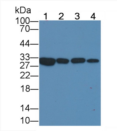 Monoclonal Antibody to Galectin 3 (GAL3)