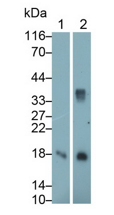 Monoclonal Antibody to Galectin 1 (GAL1)