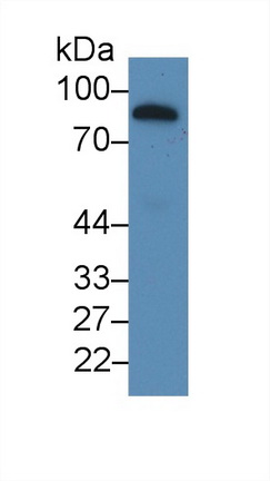 Monoclonal Antibody to Gelsolin (GSN)