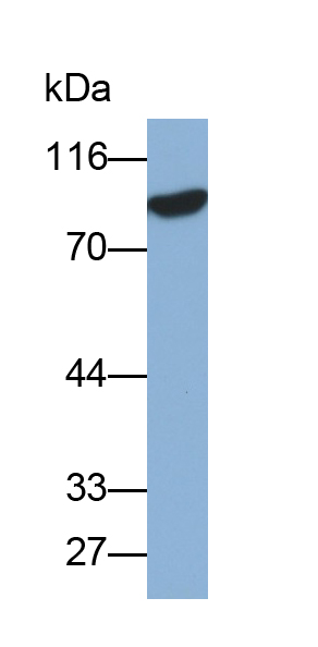 Monoclonal Antibody to Gelsolin (GSN)