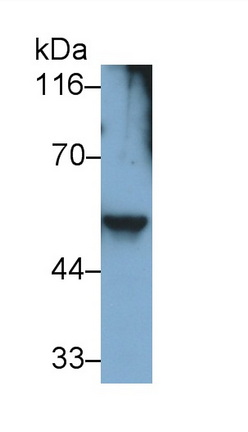 Monoclonal Antibody to Desmin (Des)