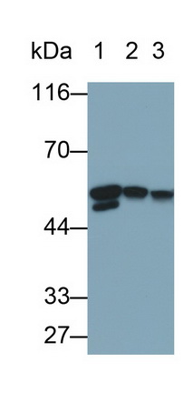 Monoclonal Antibody to Desmin (Des)