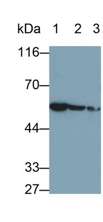 Monoclonal Antibody to Desmin (Des)