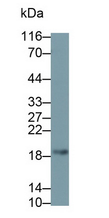 Monoclonal Antibody to Vasoactive Intestinal Peptide (VIP)