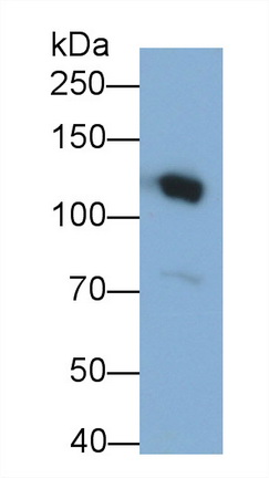 Monoclonal Antibody to Complement Component 3a (C3a)