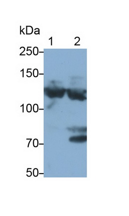 Monoclonal Antibody to Complement Component 3a (C3a)