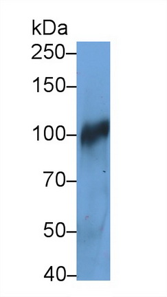 Monoclonal Antibody to Complement Component 3a (C3a)