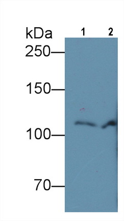 Monoclonal Antibody to Complement Component 5a (C5a)