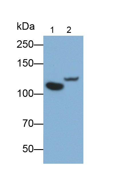 Monoclonal Antibody to Complement Component 5a (C5a)