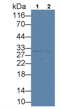 Monoclonal Antibody to Tissue Factor Pathway Inhibitor (TFPI)