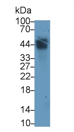 Monoclonal Antibody to Tissue Factor Pathway Inhibitor (TFPI)