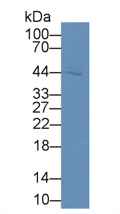 Monoclonal Antibody to Sex Hormone Binding Globulin (SHBG)