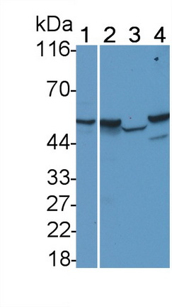 Monoclonal Antibody to Sex Hormone Binding Globulin (SHBG)