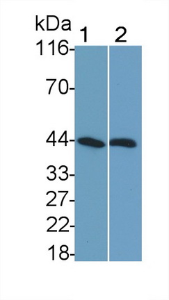 Monoclonal Antibody to Sex Hormone Binding Globulin (SHBG)