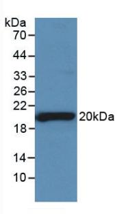 Monoclonal Antibody to Sex Hormone Binding Globulin (SHBG)