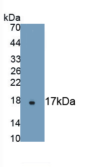 Monoclonal Antibody to Alpha-Hemoglobin Stabilizing Protein (aHSP)