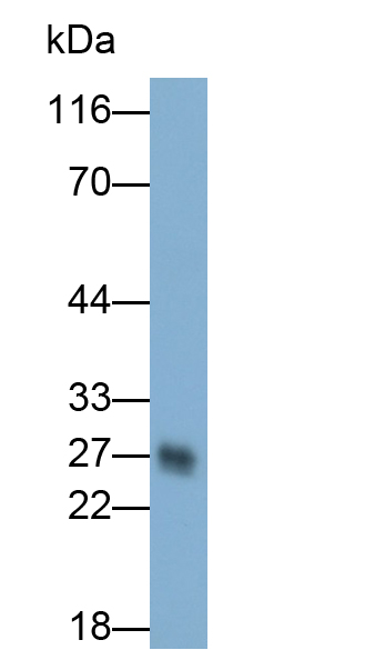 Monoclonal Antibody to Myelin Oligodendrocyte Glycoprotein (MOG)