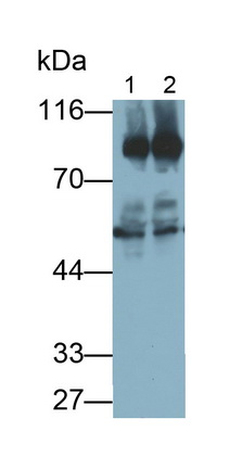 Monoclonal Antibody to Protein Kinase C Epsilon (PKCe)