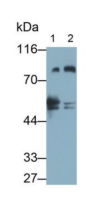 Monoclonal Antibody to Protein Kinase C Epsilon (PKCe)