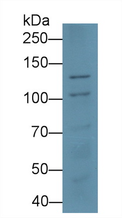 Monoclonal Antibody to Desmoglein 3 (DSG3)