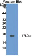 Monoclonal Antibody to Calcitonin (CT)