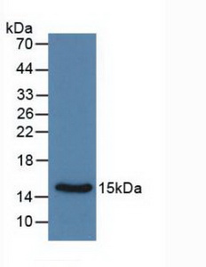 Monoclonal Antibody to Calcitonin (CT)