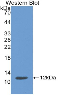 Monoclonal Antibody to Cystatin A (CSTA)