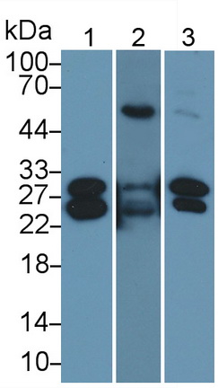 Monoclonal Antibody to Cardiac Troponin I (cTnI)