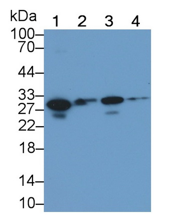 Monoclonal Antibody to Cardiac Troponin I (cTnI)