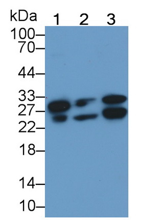 Monoclonal Antibody to Cardiac Troponin I (cTnI)