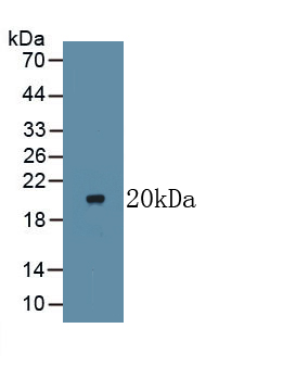 Monoclonal Antibody to Lymphotoxin Beta Receptor (LTbR)