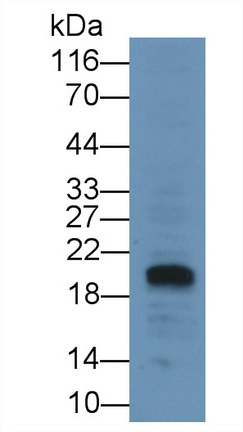 Monoclonal Antibody to N-Terminal Pro-Brain Natriuretic Peptide (NT-ProBNP)