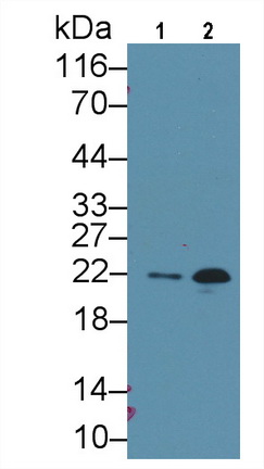 Monoclonal Antibody to N-Terminal Pro-Brain Natriuretic Peptide (NT-ProBNP)