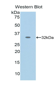 Monoclonal Antibody to Nestin (NES)