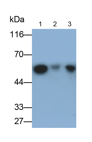 Monoclonal Antibody to Cytokeratin 15 (CK15)