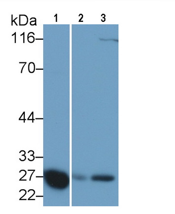 Monoclonal Antibody to Apolipoprotein A1 (APOA1)