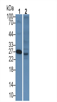 Monoclonal Antibody to Apolipoprotein A1 (APOA1)