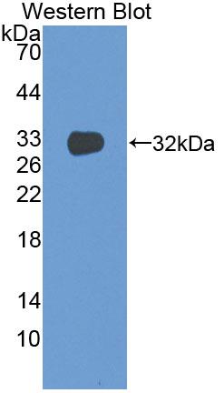 Monoclonal Antibody to Tissue Factor (TF)