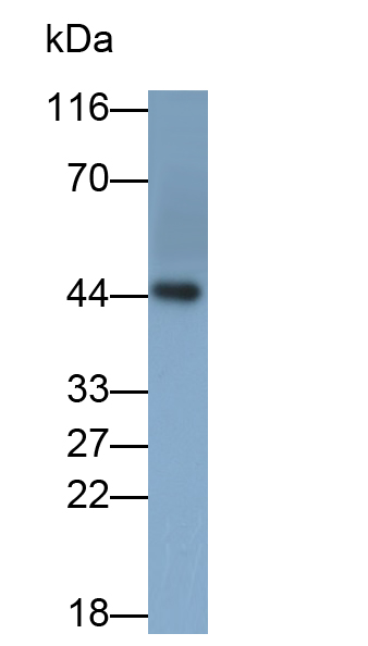 Monoclonal Antibody to Tissue Factor (TF)