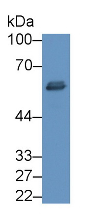 Monoclonal Antibody to Tissue Plasminogen Activator (tPA)