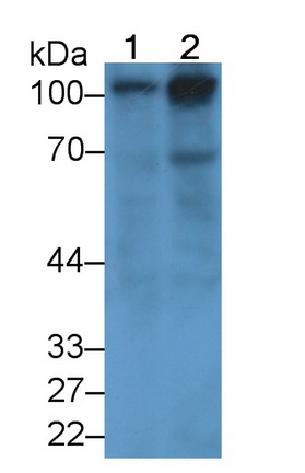 Monoclonal Antibody to Thrombomodulin (TM)