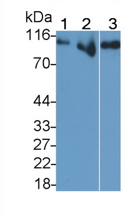 Monoclonal Antibody to Thrombomodulin (TM)