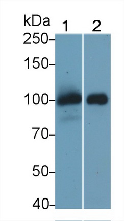 Monoclonal Antibody to Thrombomodulin (TM)